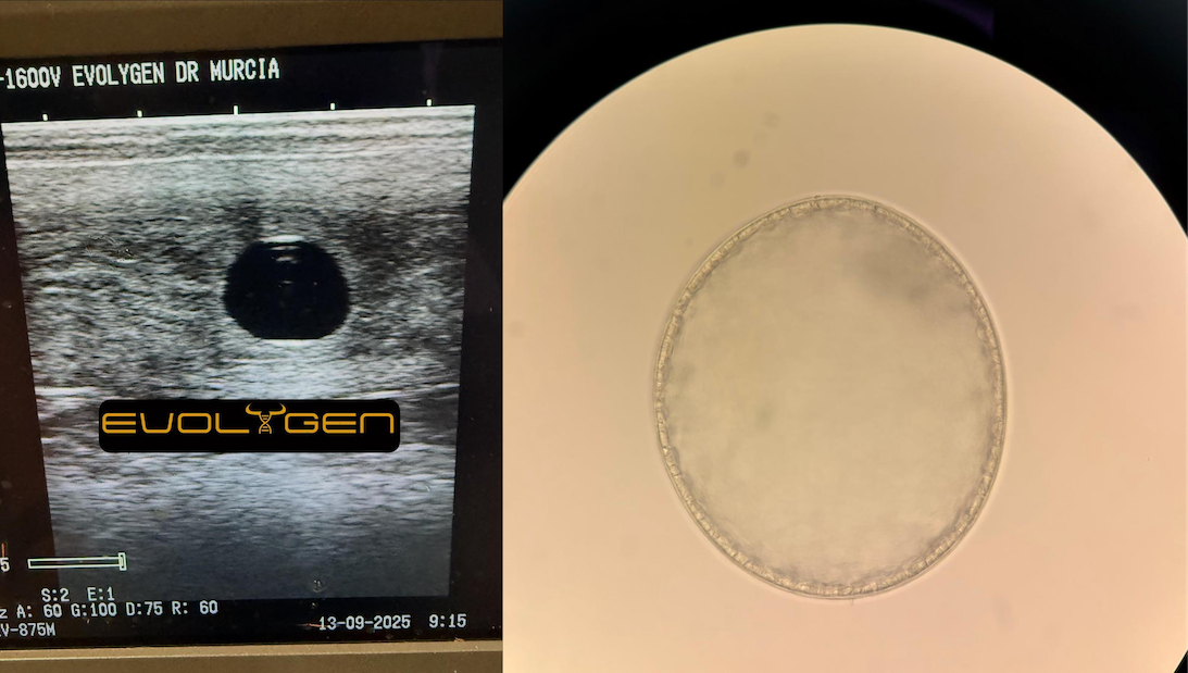 Embryo Transfer